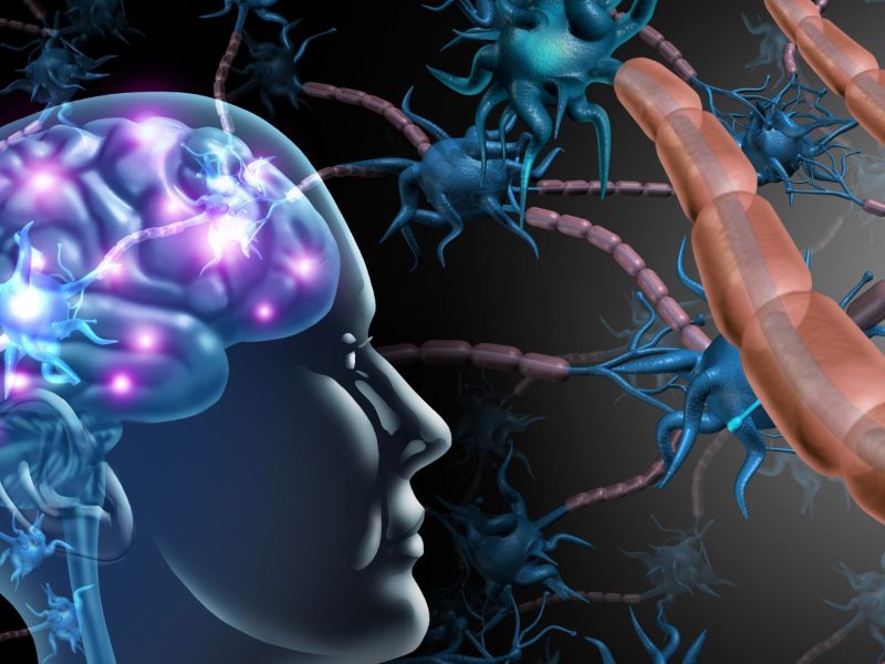 Vagus Nerve Stimulation