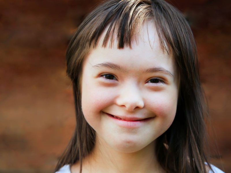 Down Syndrome