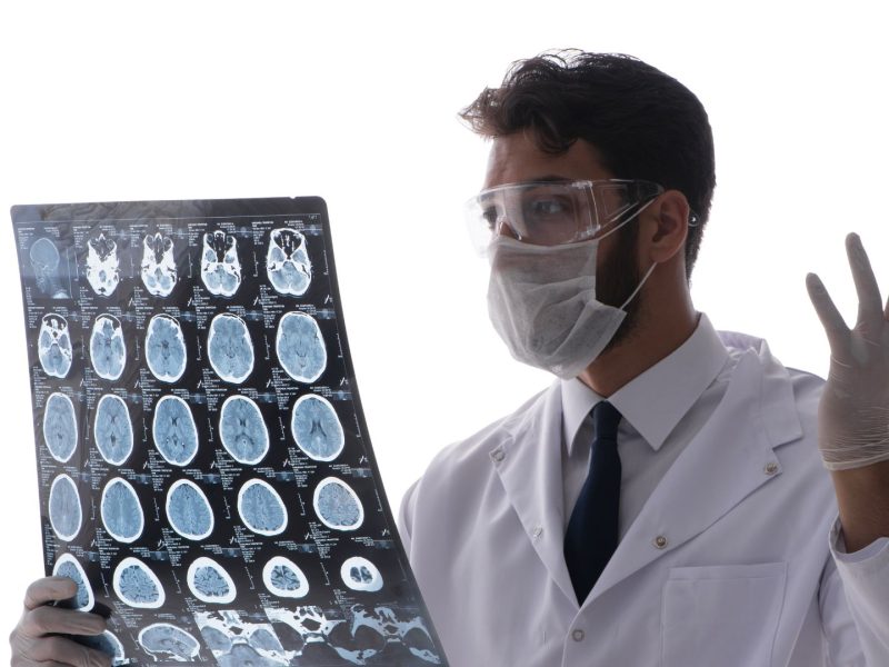 Lobotomy
