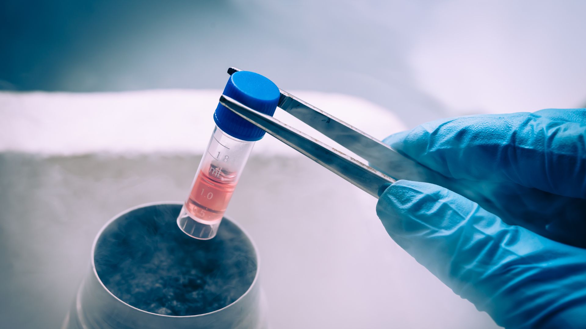 Stem Cell Treatment